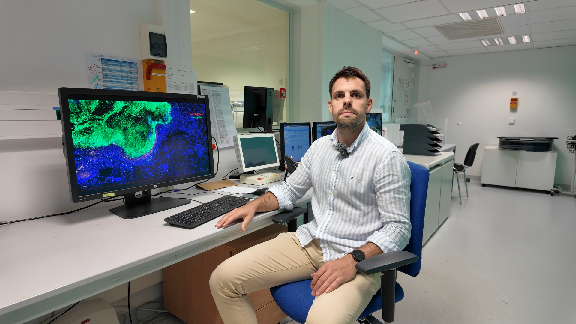 Tuberculose : des pistes pour de meilleurs diagnostic et suivi thérapeutique