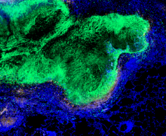 Journée mondiale de la tuberculose : des recherches menées au CEA de Fontenay-aux-Roses