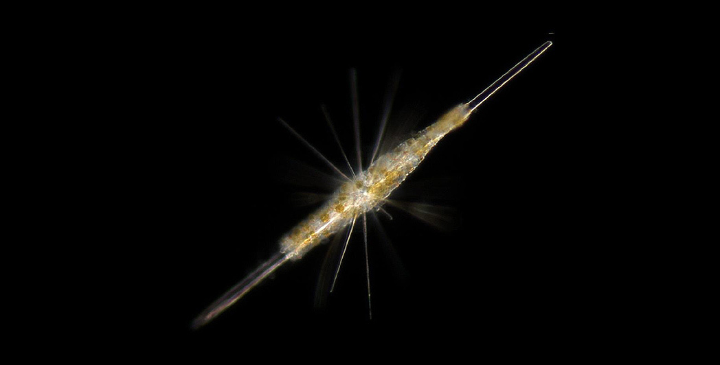 Un acanthaire (hôte) de 100-200 µm de longueur avec ses micro-algues symbiotiques intracellulaires (cellules jaunes).