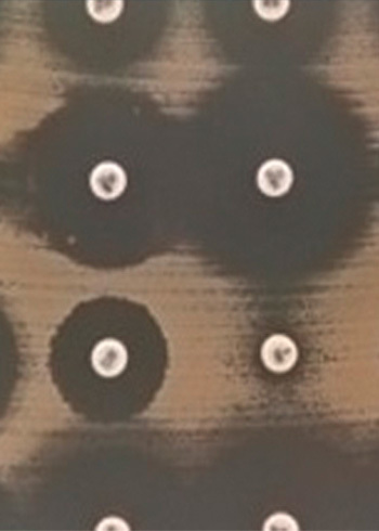 Diagnostiquer la résistance aux antibiotiques