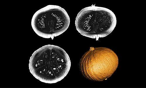L’IRM le plus puissant au monde livre ses premières images