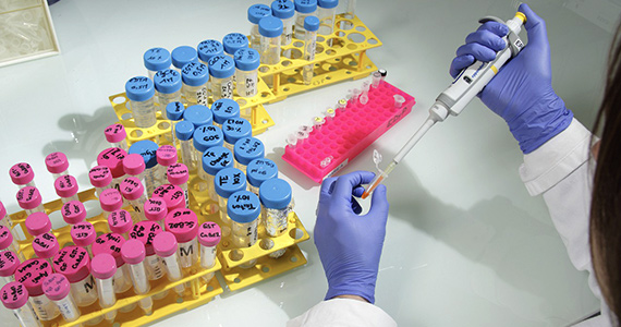 Dépister les maladies infectieuses