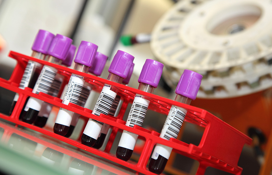 Détecter au plus vite la septicémie.