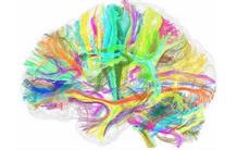 Neurospin, le cerveau en action