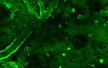 Diagnostic de la maladie d’Alzheimer : des anticorps de lama détectent les lésions cérébrales