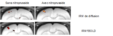 l-activite-neuronale-tache-en-couleur-reste-visible-par-irm-de-diffusion.png