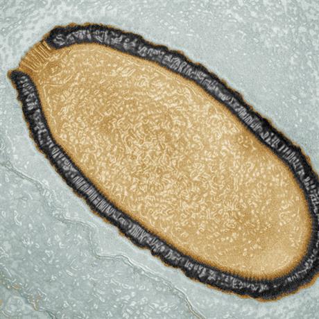 Image colorisée d'une coupe de Pithovirus sibericum observée en microscopie électronique à transmission