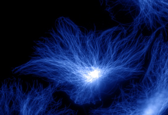 marquage des microtubules.jpg