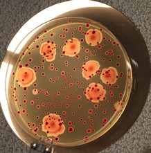 bacteries.jpg