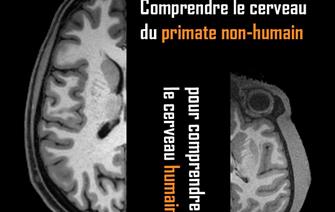 Une base de données internationale pour mutualiser l’imagerie cérébrale de primates 