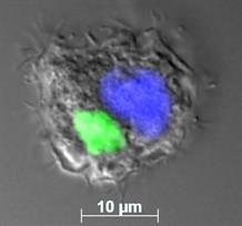Noyau (fluorescence verte, GFP) et « usine à virion » (bleu, DAPI) dans une amibe à un stage tardif d’infection par Noumeavirus. Après avoir diffusé dans toute la cellule, la fluorescence verte se retrouve confinée dans le noyau qui a retrouvé son intégrité structurale. © IGS, CNRS-AMU.