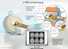 L'imagerie par résonance magnétique (IRM) anatomique