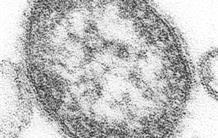 Le virus de la rougeole livre un de ses secrets