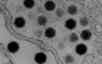 Ce virus d’amibe contrôle le noyau de son hôte à distance