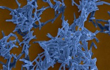L’histoire évolutive et l’émergence de la tuberculose retracées